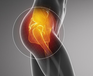 Hip joint pain, PJS Orthopaedics Melbourne