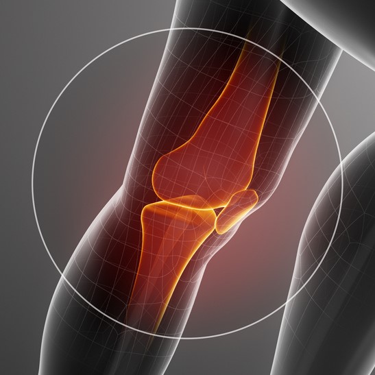 Knee pain, PJS Orthopaedics Melbourne
