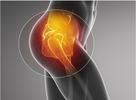 Hip pain, PJS Orthopaedics Melbourne