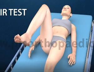 Hip rotation test 1, PJS Orthopaedics Melbourne